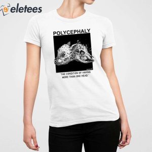 Polycephaly The Condition Of Having More Than One Head Shirt 2