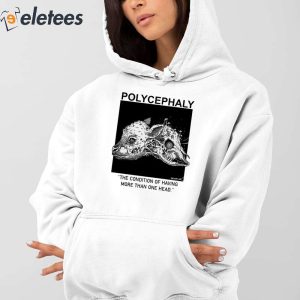 Polycephaly The Condition Of Having More Than One Head Shirt 4