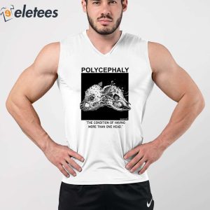 Polycephaly The Condition Of Having More Than One Head Shirt 5