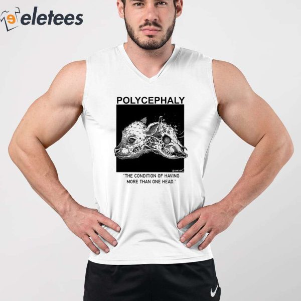 Polycephaly The Condition Of Having More Than One Head Shirt